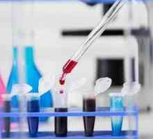 Što test krvi za CEA i zašto bi trebao uzeti?