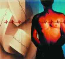 Što dijagnozu aterosklerotskog kardio