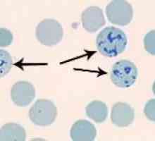 Što učiniti retikulocita u krvi