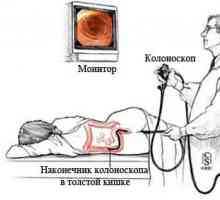 Dijagnostički postupak je kolonoskopija crijeva