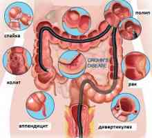 Je li moguće provjeriti crijeva bez kolonoskopiju i kako to učiniti?