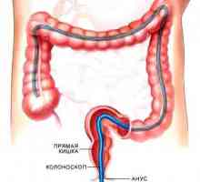 Što je sigmoidoskopija crijeva?