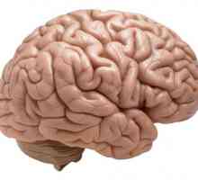 Koja proširuje žile u mozgu?
