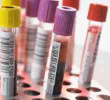 Što je krvni test ASAT i kada je potrebno poduzeti