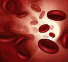Što je anemija u krvi