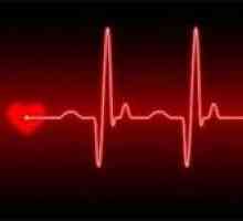 Što je srčana aritmija i da li je opasno za život?