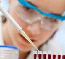 Što govori biokemijske analize krvi