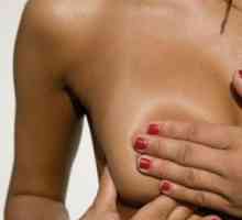 Što je difuzne fibro cistične dojke mliječne žlijezde? Sve o bolesti