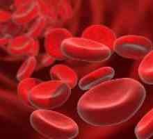 Što je krvni hemoliza i zašto se javlja?