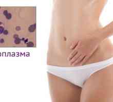 Simptomi i liječenje mikoplazme gominis