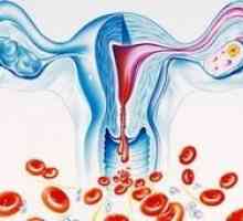 Što je teški menstruacija?