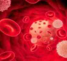 Razlozi za pad neutrofila u krvi i metode korekcije