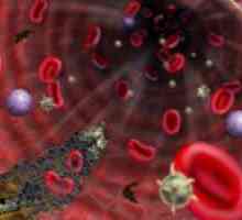 Što je lupus antikoagulans i njegova dijagnostička vrijednost