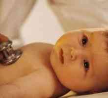 Deformacija žučnog mjehura u djece