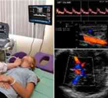 Dijagnostičke mogućnosti plovila ultrazvuk mozga