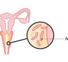 Dijagnoza i liječenje bakterijske vaginoze (bakterijska vaginoza)