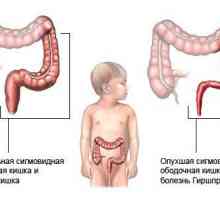 Dijagnoza i liječenje djeteta dolihosigmoy