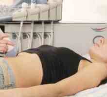 Dijagnoza mioma maternice: kada je vrijeme za ultrazvuk?