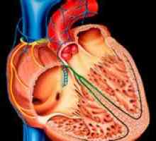 Dilatacijska kardiomiopatija (DCM) i njegovo liječenje