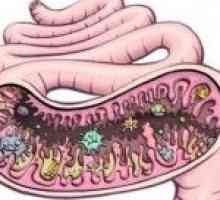 Crijevna dysbiosis - što je to? Da vidimo