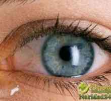 Dom i potrebi pomoć za opekotine očiju: narodnih lijekova i tretmana