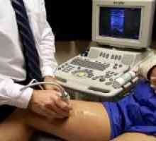 Ultrazvuk dijagnoza vaskularnih bolesti nogu