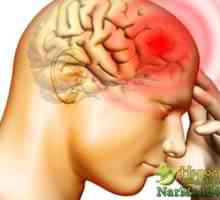 Dostupno narodni lijekovi liječenje migrene