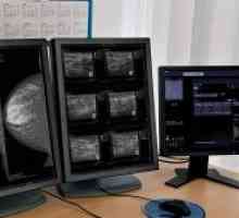 Fibroadenom raka dojke: uzroci, simptomi, indikacije za uklanjanje
