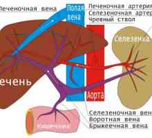 Flebotromboz: duboke vene donjih ekstremiteta, površine, goljenice, donja šuplja vena