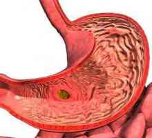 Gastritis - Liječenje i dijagnostika
