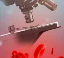 Uzroci niskog hematokrita u krvi