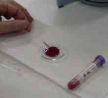 Razlozi povećane hematokrita u krvi