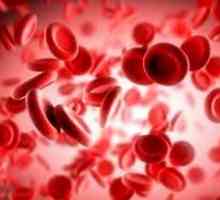 Hemolitička anemija