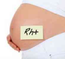 Što trebate znati o Rh faktoru na fazi planiranja trudnoće