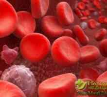Hematologija upozorava kako manifestirati i liječi trombocitopeniju