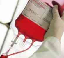 Krv Kompatibilnost grupa i Rh faktor transfuzija