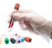 Test krvi za kalcitonin - funkcija, standardima i obuku