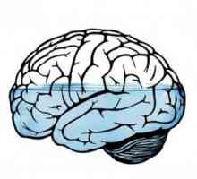Hidrocefalusa (edem mozga): uzroci, simptomi, kako se postupa, učinci