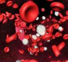Hyperchromic anemija