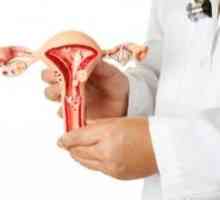 Hiperplazija endometrija - kako prepoznati simptome? pravilnu dijagnozu