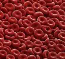 Glavni razlozi za smanjenje crvenih krvnih stanica