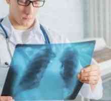 Dojenja i rendgenske zrake: i protiv