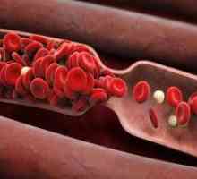 Gusta krv u muškaraca i žena: uzroci, simptomi i liječenje lijeka i hrane