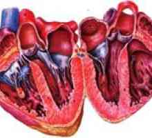 Simptomi prirođenih i stečenih srčanih mana