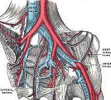 Ileofemoralny tromboza donjih udova