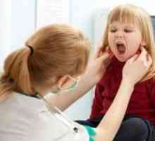 Infektivna mononukleoza: simptomi u djece. Mišljenje dr Komarovsky