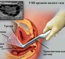 Intimni pitanja: Da li je moguće napraviti ultrazvuk za vrijeme menstruacije? 2