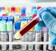 Test krvi za procjenu utjecaja na okoliš