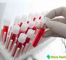 Studija o Petit i set: kome se preporučuje i da pokazuje test krvi