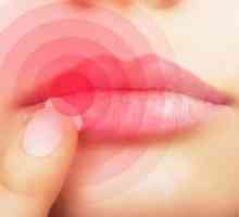 Učinkovito liječenje prehlade usne